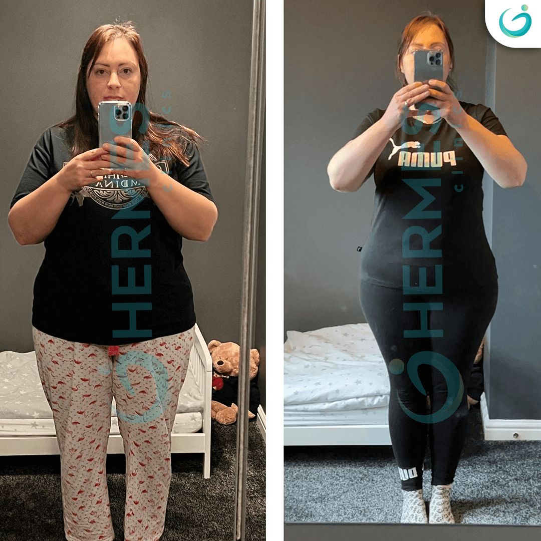 hermes before after (10)