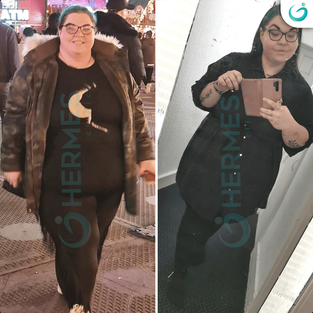 hermes before after (12)