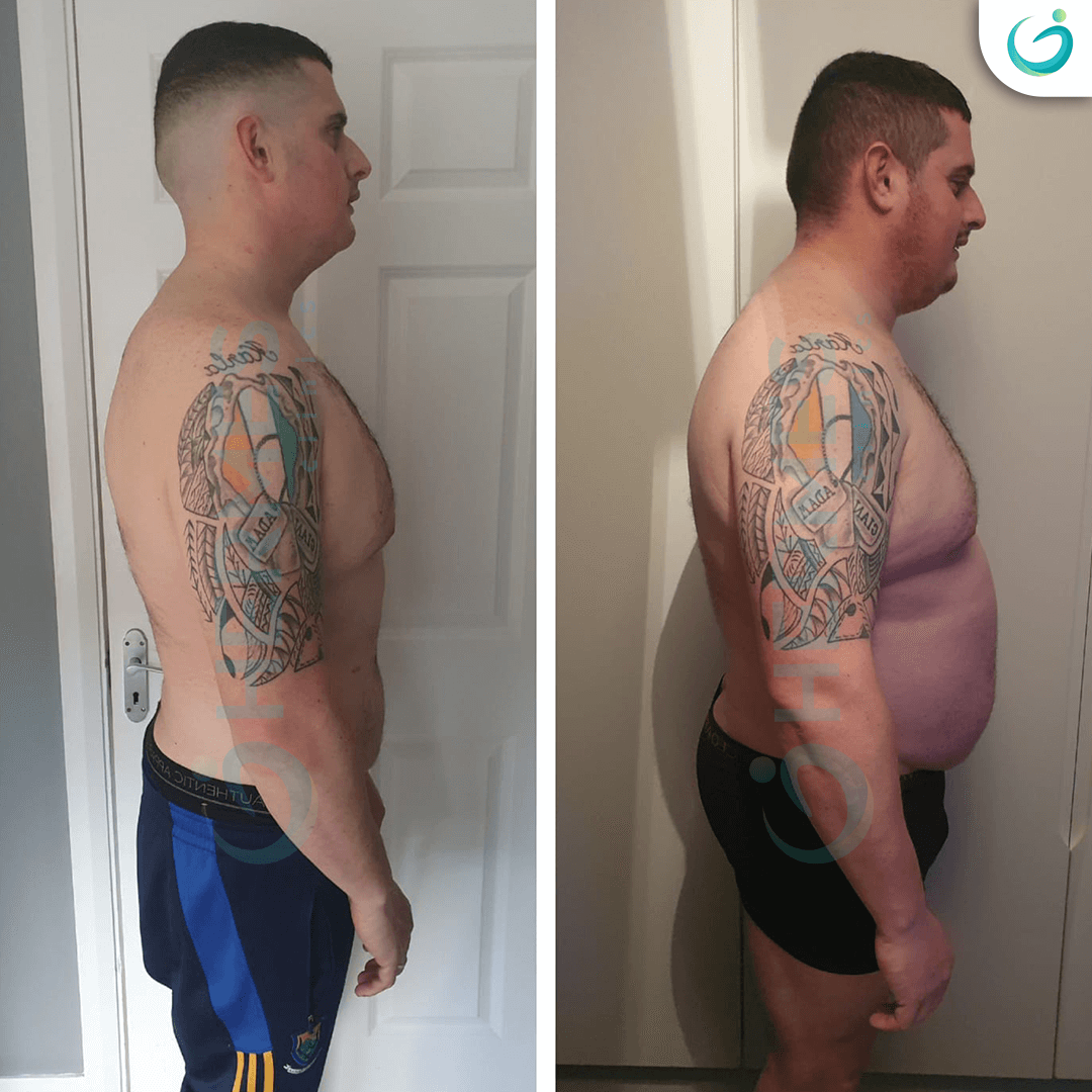 hermes before after (13)