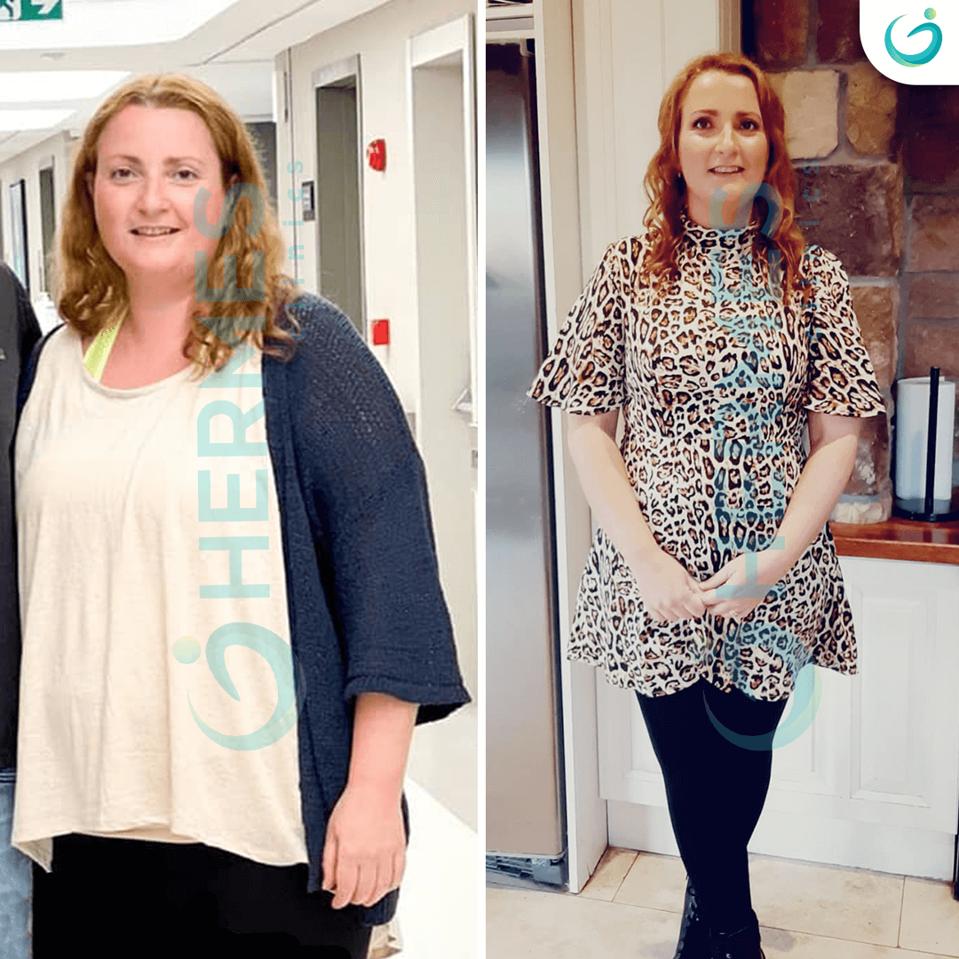 hermes before after (6)