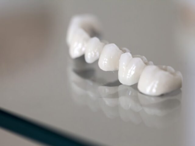 Porcelain Veneers in Turkey