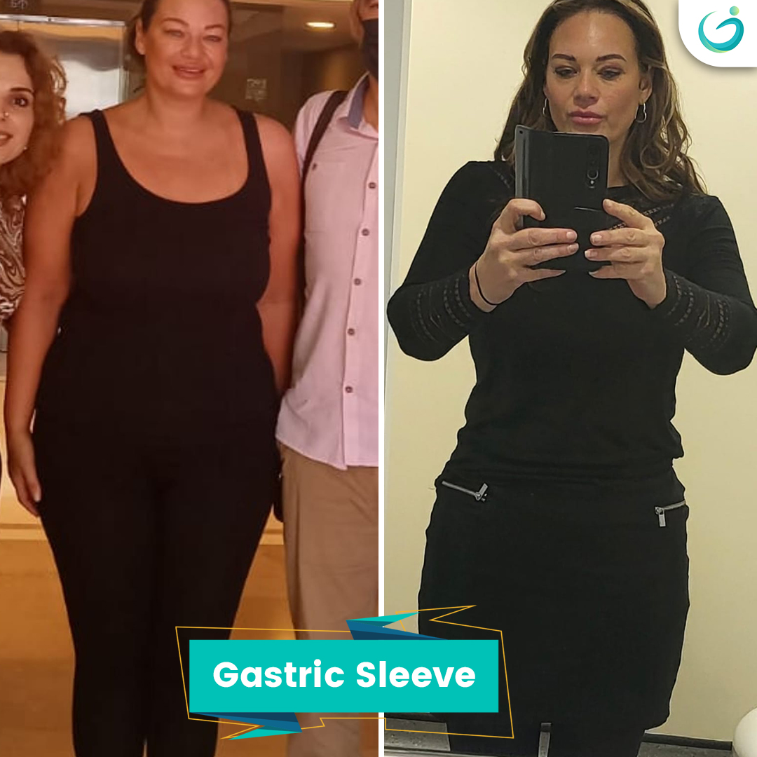 Before After - 44 Sarah bower