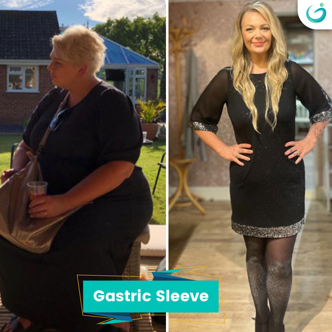 Before After - 48 Lynn (1)