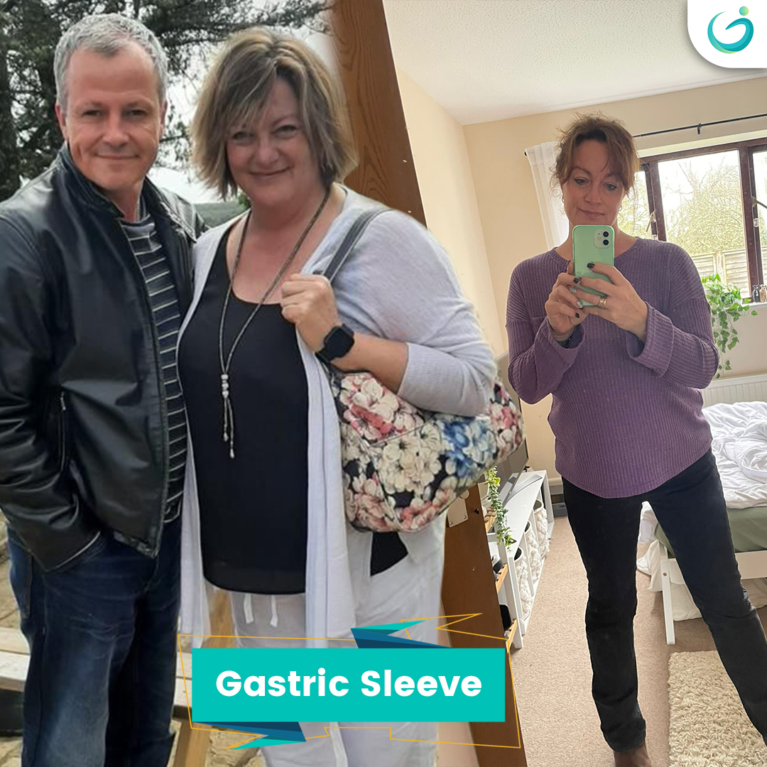 Before After - 63 stephanie