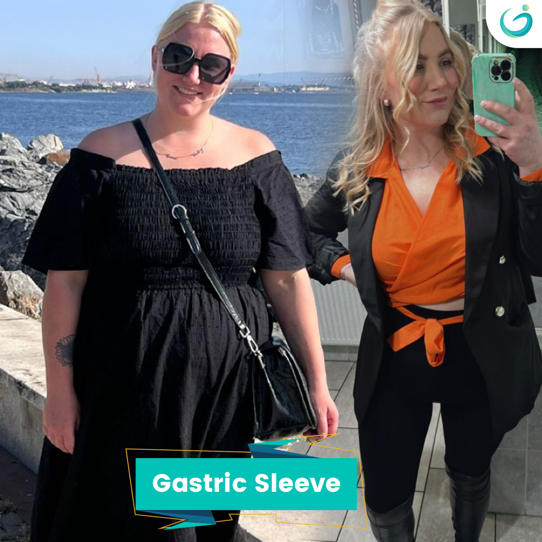 Before After - 82 haylay